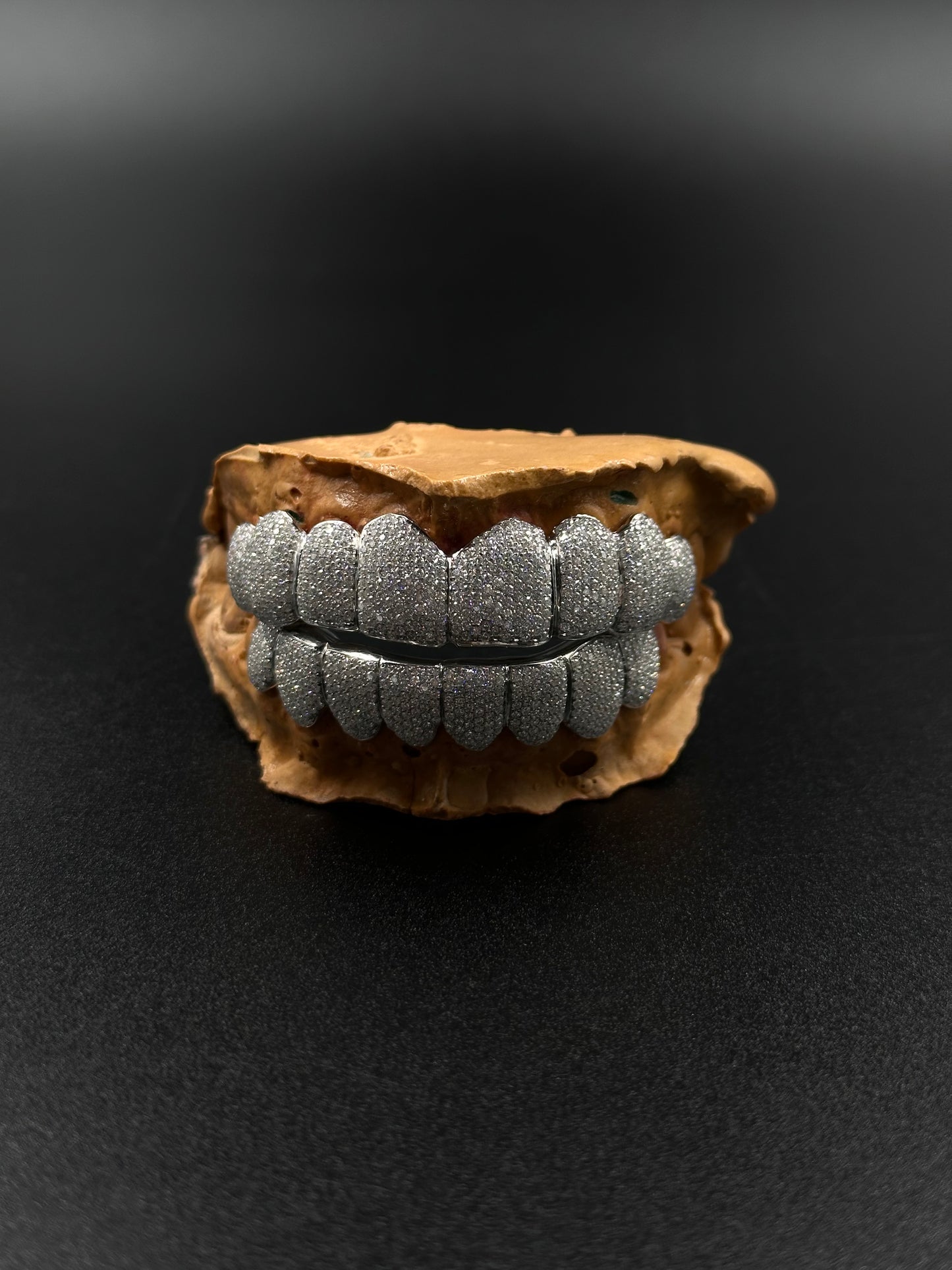 Grillz custom (nombre de dents au choix)