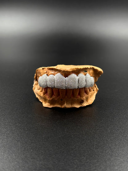 Grillz custom (nombre de dents au choix)