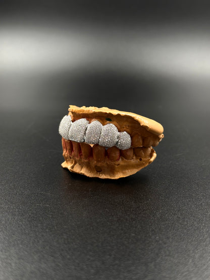 Grillz custom (nombre de dents au choix)