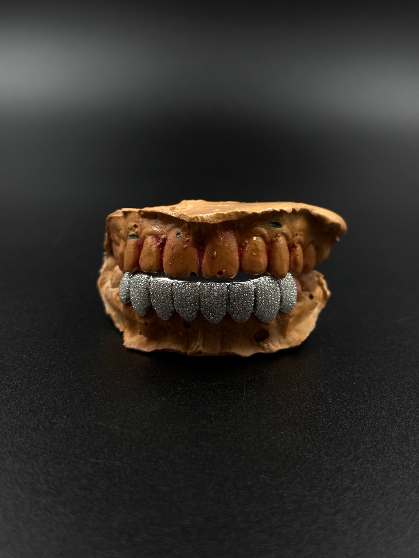 Grillz custom (nombre de dents au choix)