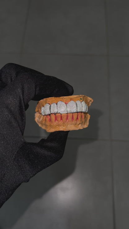 Grillz custom (nombre de dents au choix)