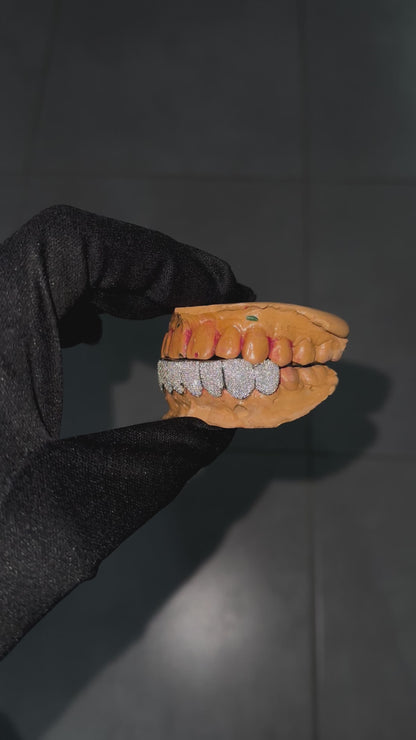Grillz custom (nombre de dents au choix)